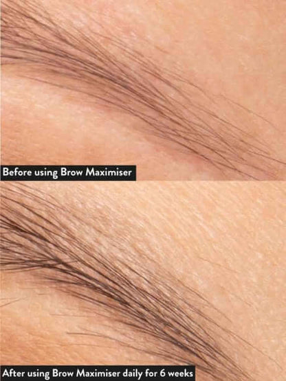 Brow Maximiser